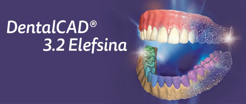 exocad will introduce DentalCAD 3.2 Elefsina with more than 60 new features and enhanced workflows for clinics, labs, and production centers. (Source: exocad)